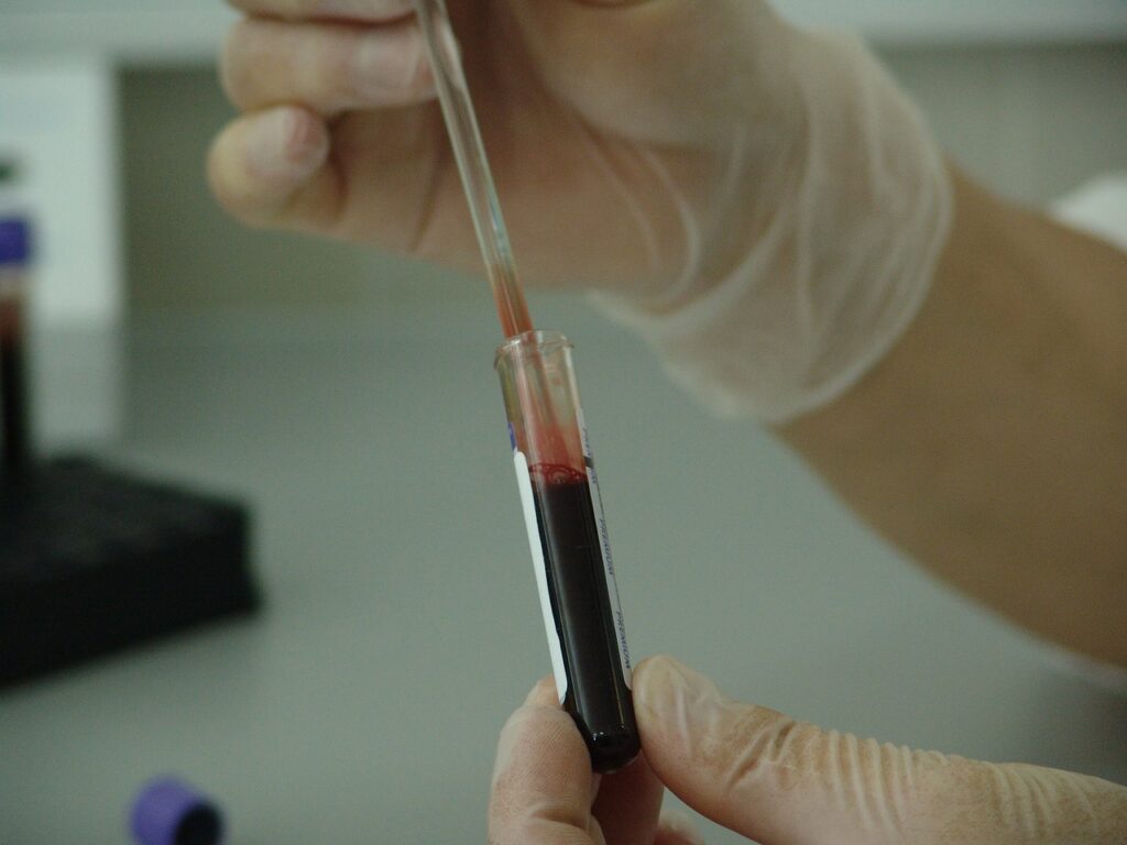 blood, vial, analysis-20745.jpg